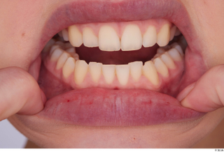 Harley teeth 0003.jpg